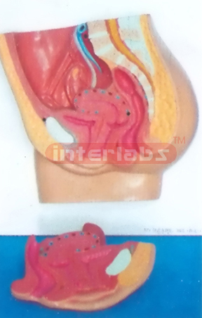 HUMAN ADVANCED FEMALE MORBIDITY ABDOMINAL CAVITY MODEL PLAT TYPE HANGING